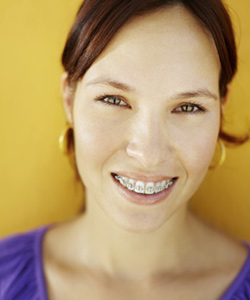 Adult Braces In Northern California