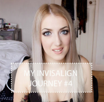 Invisalign Journey Video Testimonial