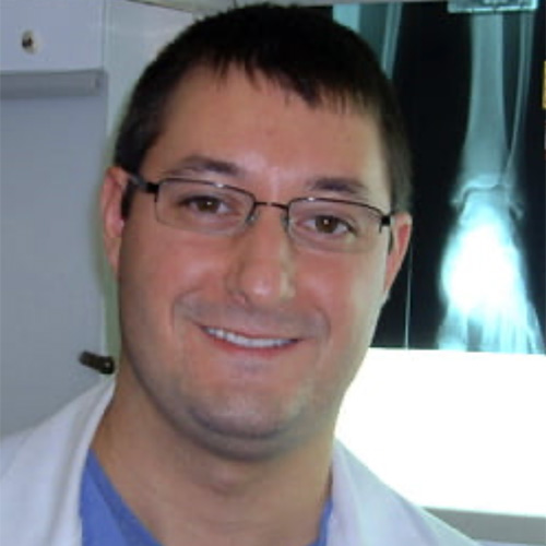 Total Ankle Replacement Surgeon, Dr. Jason Nowak in Redding