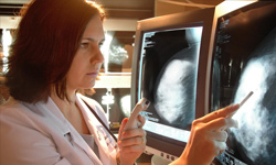 MD Imaging, Benefit of Mammograms